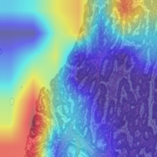 Grad-CAM heatmap over the same slide